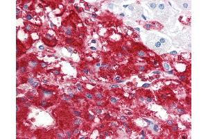 Anti-IFNL1 / IL29 antibody IHC staining of human adrenal. (IL29 antibody  (AA 54-85))