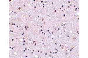 Immunohistochemistry of TMP21 in human brain tissue with this product at 5 μg/ml. (TMED10 antibody  (Center))