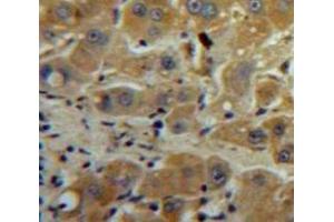 #VALUE! (TIMP1 antibody  (AA 24-217))