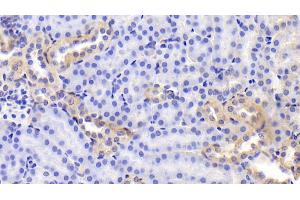 Detection of FN in Mouse Kidney Tissue using Polyclonal Antibody to Fibronectin (FN) (Fibronectin antibody  (AA 2117-2236))
