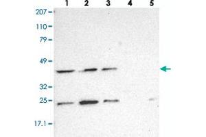 Western blot analysis of Lane 1: RT-4, Lane 2: EFO-21, Lane 3: A-431, Lane 4: Liver, Lane 5: Tonsil with DRG1 polyclonal antibody .