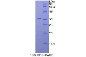 SDS-PAGE (SDS) image for Myosin ID (MYO1D) (AA 581-847) protein (His tag) (ABIN2121686) (Myosin ID Protein (MYO1D) (AA 581-847) (His tag))