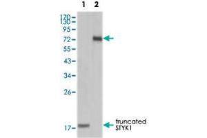 Western blot analysis using STYK1 monoclonal antibody, clone 2H2F10  against truncated STYK1 recombinant protein(1) and STYK1 (aa 47-422)-hIgGFc transfected CHO-K1 cell lysate (2).