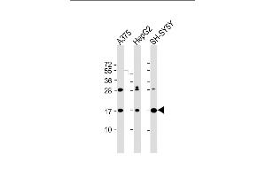 All lanes : Anti-SRP14 Antibody (Center) at 1:2000 dilution Lane 1:  whole cell lysate Lane 2: HepG2 whole cell lysate Lane 3: SH-SY5Y whole cell lysate Lysates/proteins at 20 μg per lane. (SRP14 antibody  (AA 28-55))