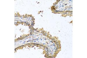 Immunohistochemistry of paraffin-embedded human prostate using RNASE11 antibody at dilution of 1:100 (40x lens).