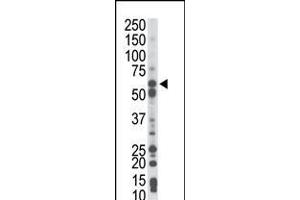 Antibody is used in Western blot to detect PCK1 in mouse liver tissue lysate. (PCK1 antibody  (N-Term))