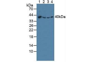 Figure. (SQSTM1 antibody  (AA 136-400))
