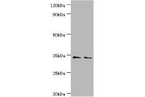 Western blot All lanes: Killer cell immunoglobulin-like receptor 2DS4 antibody at 4 μg/mL Lane 1: K562 whole cell lysate Lane 2: Jurkat whole cell lysate Secondary Goat polyclonal to rabbit IgG at 1/10000 dilution Predicted band size: 34 kDa Observed band size: 34 kDa (KIR2DS4 antibody  (AA 22-245))
