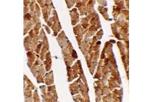 Immunohistochemistry of TGM5 in mouse heart tissue with TGM5 antibody at 2. (Transglutaminase 5 antibody  (C-Term))