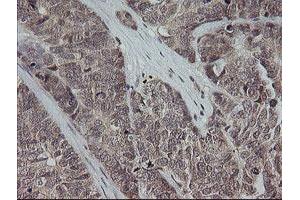 Image no. 7 for anti-Mitogen-Activated Protein Kinase Kinase 3 (MAP2K3) antibody (ABIN1499403)