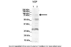 Lanes:  1. (VCP antibody  (C-Term))