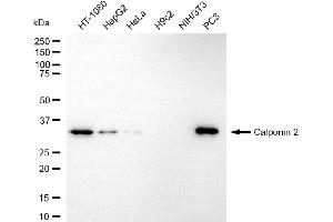 Western blotting analysis using calponin 2 antibody (ABIN7797852). (CNN2 antibody)