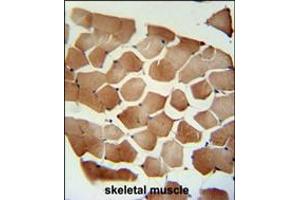 FLCN Antibody immunohistochemistry analysis in formalin fixed and paraffin embedded human skeletal muscle followed by peroxidase conjugation of the secondary antibody and DAB staining. (FLCN antibody  (C-Term))