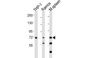Western Blot at 1:2000 dilution Lane 1: THP-1 whole cell lysates Lane 2: Ramos whole cell lysates Lane 3: mouse spleen lysates Lysates/proteins at 20 ug per lane. (SYK antibody  (AA 268-305))
