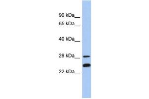 WB Suggested Anti-NSMCE2 Antibody Titration: 0. (NSMCE2 antibody  (Middle Region))