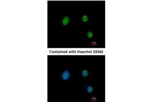 ICC/IF Image Immunofluorescence analysis of paraformaldehyde-fixed HeLa, using PAX9, antibody at 1:200 dilution. (PAX9 antibody)