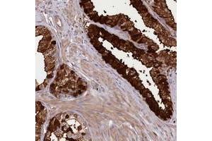 Immunohistochemical staining of human prostate with KIAA1731 polyclonal antibody  shows strong cytoplasmic and membranous positivity in glandular cells at 1:200-1:500 dilution. (KIAA1731 (KIAA1731) antibody)