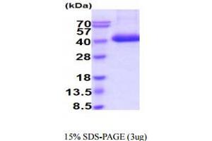 SDS-PAGE (SDS) image for Tissue Factor Pathway Inhibitor (Lipoprotein-Associated Coagulation Inhibitor) (TFPI) (AA 29-304) protein (His tag) (ABIN7529364) (TFPI Protein (AA 29-304) (His tag))