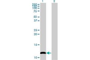 Western Blot analysis of COX6B1 expression in transfected 293T cell line by COX6B1 monoclonal antibody (M02), clone 2D3. (COX6B1 antibody  (AA 1-86))