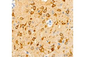 Immunohistochemistry (Paraffin-embedded Sections) (IHC (p)) image for anti-N-terminal EF-Hand Calcium Binding Protein 1 (NECAB1) antibody (ABIN7074753)