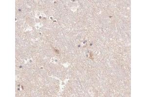 ABIN6266625 at 1/100 staining human brain tissue sections by IHC-P. (KCNC2 antibody  (C-Term))