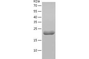 Western Blotting (WB) image for Lin-28 Homolog A (C. Elegans) (LIN28A) (AA 3-182) protein (His tag) (ABIN7123766) (LIN28A Protein (AA 3-182) (His tag))