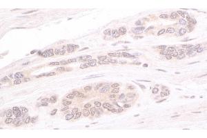 Immunohistochemistry (IHC) image for anti-ATR Interacting Protein (ATRIP) (AA 100-150) antibody (ABIN7453575)