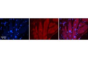 Rabbit Anti-TRPV4 Antibody  Catalog Number: ARP35331_P050 Formalin Fixed Paraffin Embedded Tissue: Human Adult heart  Observed Staining: Cytoplasmic Primary Antibody Concentration: 1:100 Secondary Antibody: Donkey anti-Rabbit-Cy2/3 Secondary Antibody Concentration: 1:200 Magnification: 20X Exposure Time: 0. (TRPV4 antibody  (N-Term))