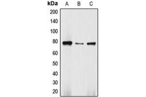 Western blot analysis of DBF4 expression in Jurkat (A), HepG2 (B), SW480 (C) whole cell lysates. (DBF4 antibody  (N-Term))