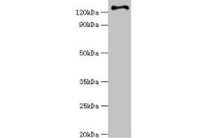 Western blot All lanes: RET antibody at 6 μg/mL + Hela whole cell lysate Secondary Goat polyclonal to rabbit IgG at 1/10000 dilution Predicted band size: 125, 120 kDa Observed band size: 125 kDa (Ret Proto-Oncogene antibody  (AA 29-300))
