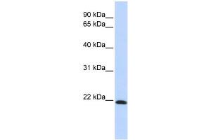 WB Suggested Anti-CLDN7 Antibody Titration:  0. (Claudin 7 antibody  (Middle Region))