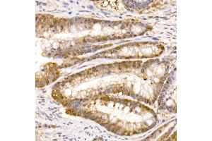Immunohistochemistry of paraffin-embedded human colon carcinoma using Bag1 Rabbit mAb (ABIN7265847) at dilution of 1:50 (40x lens). (BAG1 antibody)