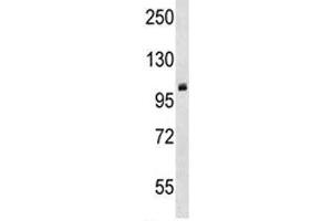 PRMT10 antibody western blot analysis in mouse cerebellum tissue lysate. (PRMT10 antibody  (AA 39-68))