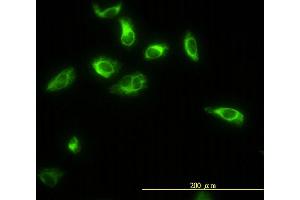 Immunofluorescence of monoclonal antibody to TPMT on HeLa cell. (TPMT antibody  (AA 1-245))