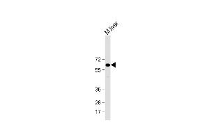 Anti-IL1R Antibody (Center) at 1:2000 dilution + Mouse liver lysate Lysates/proteins at 20 μg per lane. (IL1RAP antibody  (AA 279-313))