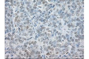 Immunohistochemical staining of paraffin-embedded Ovary tissue using anti-SORDmouse monoclonal antibody. (SORD antibody)