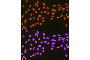 Immunofluorescence analysis of C6 cells using EWSR1 Rabbit mAb (ABIN7267053) at dilution of 1:100 (40x lens). (EWSR1 antibody)