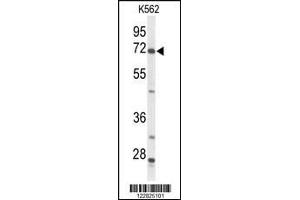 Western blot analysis of ACSS2 Antibody in K562 cell line lysates (35ug/lane) (ACSS2 antibody  (N-Term))