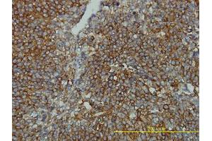 Image no. 1 for anti-Clathrin, Light Chain B (CLTB) (AA 1-212) antibody (ABIN598618) (CLTB antibody  (AA 1-212))