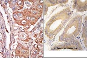 Image no. 1 for anti-Fibroblast Growth Factor 4 (FGF4) (C-Term) antibody (ABIN360661) (FGF4 antibody  (C-Term))