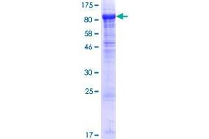 BBS2 Protein (AA 1-721) (GST tag)