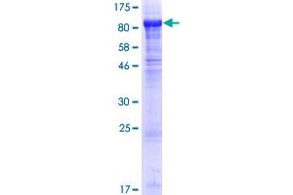 BBS2 Protein (AA 1-721) (GST tag)