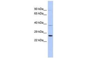 Image no. 1 for anti-SAR1 Homolog B (SAR1B) (AA 107-156) antibody (ABIN6744023) (SAR1B antibody  (AA 107-156))