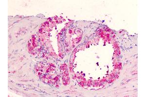 Human Prostate: Formalin-Fixed, Paraffin-Embedded (FFPE) (GPR183 antibody  (Extracellular Domain))