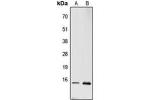 Western blot analysis of RPL22 expression in PC12 (A), MCF7 (B) whole cell lysates. (RPL22 antibody  (Center))