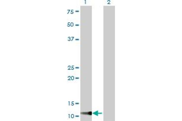 TIMM9 antibody  (AA 1-89)