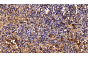 Detection of TF in Porcine Lymph node Tissue using Polyclonal Antibody to Transferrin (TF) (Transferrin antibody)