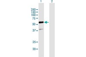 Western Blot analysis of GTF2E1 expression in transfected 293T cell line by GTF2E1 MaxPab polyclonal antibody.