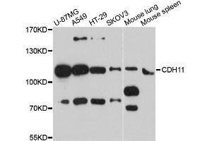 Western blot analysis of extracts of various cell lines, using CDH11 antibody. (OB Cadherin antibody)
