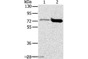 Western blot analysis of Human testis and human placenta tissue, using PIAS1 Polyclonal Antibody at dilution of 1:200 (PIAS1 antibody)